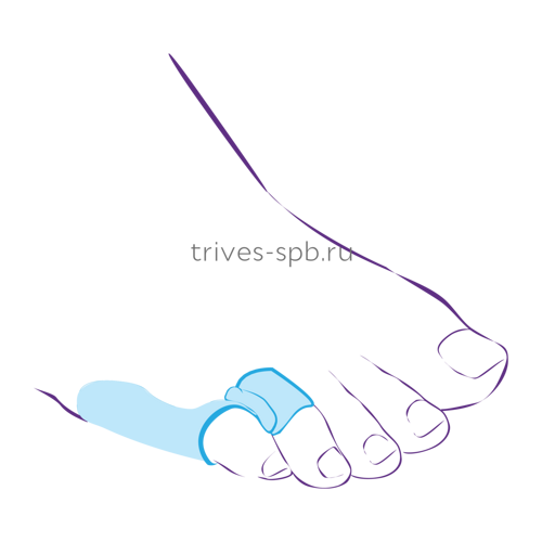 Перегородка межпальцевая, совмещенная с протектором сустава ТРИВЕС СТ-52.2