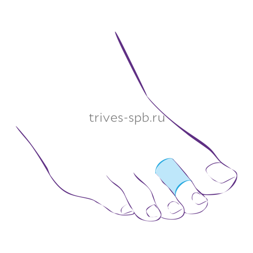 Кольца силиконовые для защиты пальцев стопы ТРИВЕС СТ-45